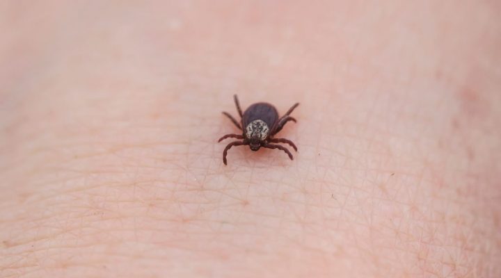 Close-up of a tick on human skin, highlighting the need for effective pest control.